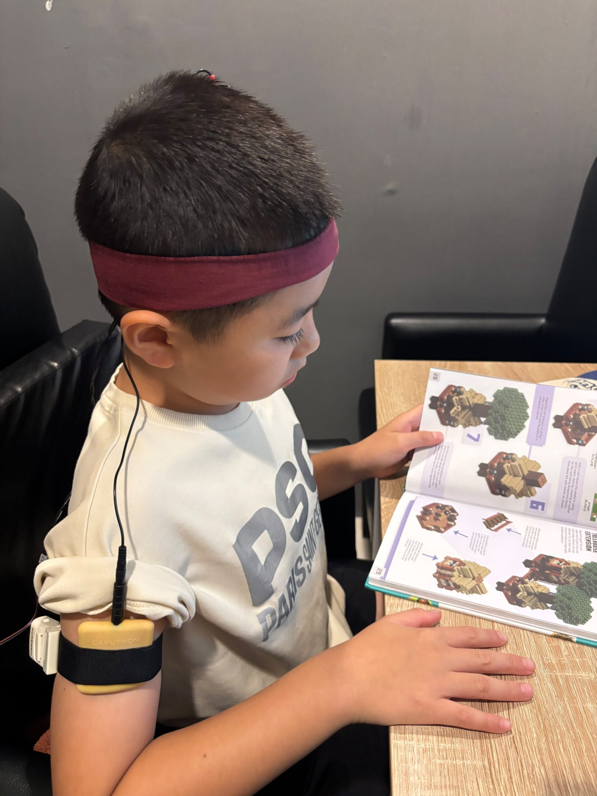 tDCS therapy